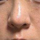 (주)펜타웍스 | 메타소닉 에스텔라 펜타 사용후기 [Day 7]
