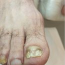 레푸스 구로점 이미지