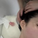 강남얼굴관리 매일이스무살 후기