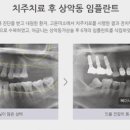연세사랑니치과의원 이미지