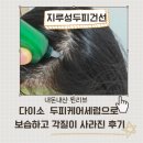 (주)엔피바이옴 | 다이소두피쿨링&보습앰플 한달 후 두피건선각질이 사라졌다!