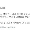 네일 선수 검진 결과 이미지