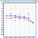 유니트론 보청기 | 원당 고양 보청기/ 블루투스 보청기 유니트론 후기