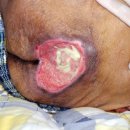 서안산노인전문병원 | 욕창 병원 추천 (효림요양병원 서울스마트요양병원 자애요양병원 일산 서안산노인전문병원 서울 수도권)