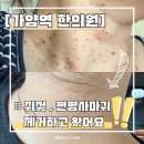 [가양역 한의원] 편평사마귀, 쥐젖 거우침 제거 후기