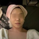 [아산] 아산 피부관리, 플라즈마+물방울리프팅 브니엘에스테틱 후기
