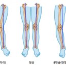 블러썸PT 이미지