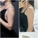 분당피부관리 결이고은 분당점 웨딩관리 팔뚝 승모근 후기