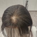 해진헤어라인