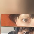 이뻐진개 | 이것은 쌍수 후기 글입니다.