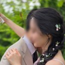 모호스튜디오 | 얼굴지방흡입 4개월차, 이제 진짜 결과 나타나는 시기? (라인변화, 결혼준비, 스튜디오 촬영 후기)