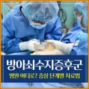 방아쇠 수지 증후군 병원 어디로? 원인과 증상 단계별 치료 방법은