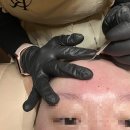 라포뷰티 | 수원 금곡동 피부관리 ‘라포뷰티’ 데미지케어 후기