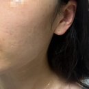 [경기/부천] 부천피부관리 사운드바디 사운드스킨 부천 Avenue 센터 더블임팩트 관리 솔직후기