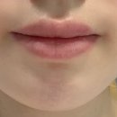 [로아뷰티끄] 용인기흥 입술문신 시술 / 틴트립 리얼 후기 ꕤ