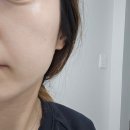 판테놀 크림 효과 샤블RX라이트 민감피부 당김 관리 후기