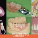 라인프레임기공소 네이버블로그