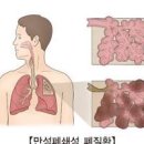 가슴이 답답하고 숨이 차는 증상 이유 이미지