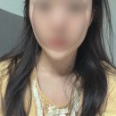 독일의원 | [닥터에버스의원 마곡] 독일 제오민 턱보톡스 100유닛 맞은 내돈내산 후기