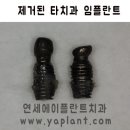 신사플란트치과병원 이미지