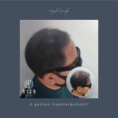 조선스칼프 이미지