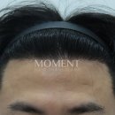 모먼트의원