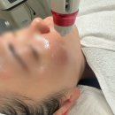 티에스샵 | 리틀헤이나 운정점 스킨부스터 에어티에스 물광관리 받고 온 후기