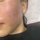 씨유 광주풍암탑점 | 개강하기 전에 받았던 관리 후기 (프락셀, 쥬베룩, 속눈썹 펌)