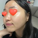 피부이야기 이미지