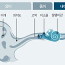 우리소리보청기 이미지