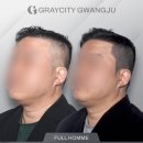 흥미헤어라인 이미지