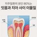 모어화이트음파 전동칫솔 추천 후기 휴대용케이스까지 완벽