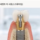 365핵심플러스치과의원 | 365핵심플러스치과는 환자의 ‘지금’이 아니라 ‘앞으로’를 생각합니다. 임플란트 고민이라면｜365...