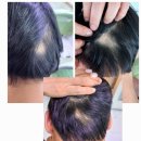 이뮤셀의원 이미지