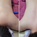 빛채움에스테틱 이미지