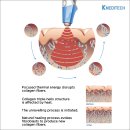 엘리트메디 이미지