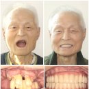 해광상회 | 올온포 비용 및 효과? 가장 많이 묻는 BEST 3