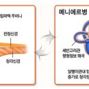 뉴톤보청기 의정부지사 이미지