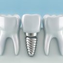 하양탑치과의원 이미지