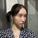 케이엔젤성형외과의원 | [공지] 부산 눈밑지방재배치 후기 1탄(병원결정~수술3일차 까지의 기록)