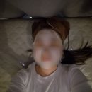 [일상] 편평사마귀 제거 후기 + 오일장 나들이
