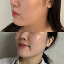 김해 윤곽관리 바름바디케어 1회만으로 얼굴형 보정 완료