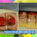 크라운치과기공소 이미지