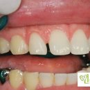 애플치과기공소 이미지