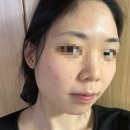 진스케어 | 인천 청라 피부관리샵 추천 | 유어스케어 피부관리 후기