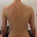 [부산/다대포] 사하구다대포피부관리 리움에스테틱 후기