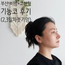 부산 비염·코성형 기능코 수술 2일차, 3일차 드레싱, 붓기 멍 후기