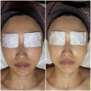상동 현대아파트 상가 | 부천 상동 더헤르츠스킨 피부맞춤관리, 얼굴 라인 달라진 윤곽관리 후기 | 수기관리 잘하는곳