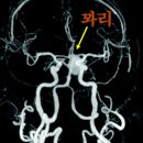 큰별치과의원 에스카사