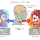 갑상샘 갑상선 기능 저하증 원인 검사 약 (체중증가 손발붓기 무기력증) 이미지